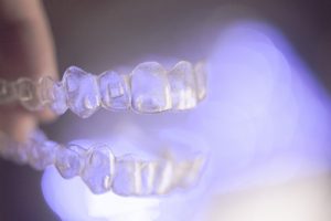 Invisalign attachments Center City orthodontist