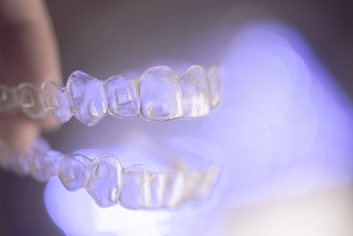 Why Do I Need Attachments Glued to My Teeth for Invisalign?