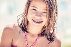 youth braces center city orthodontist summer