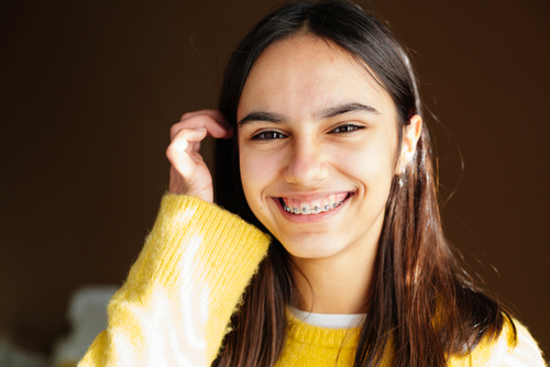 5 Facts About Rubber Bands for Braces That You Must Know