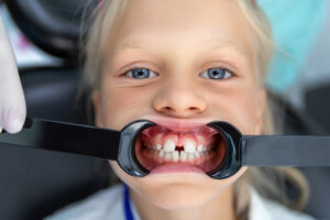 braces for kids center city orthodontist roberts and de marsche