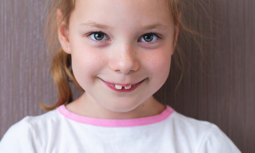 Some Braces for Kids Start with Orthodontic Expanders - Roberts & de Marsche